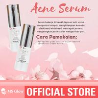 Gambar MS Glow Acne Serum ( Solusi Ampuh Jerawat Bandel ) dari MS GLOW OFFICIAL INDONESIA STORE undefined 2 Tokopedia