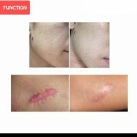 Gambar cream penghilang bekas luka 60g dari Stylish angel undefined 4 Tokopedia