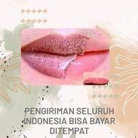 Gambar PENCERAH BIBIR TERAMPUH - Basic dari modernlifehealth undefined 1 Tokopedia