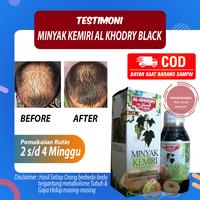Gambar Minyak Kemiri Black Al Khodry Obat Penumbuh Penyubur Penghitam Rambut dari FIFASHOPINDO undefined 2 Tokopedia