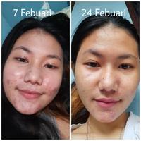 Gambar VAVL BEAUTY PAKET KOMPLIT 1 BY VIVALENTINE (FREE GIFT) dari VAVLBEAUTY_BOGOR PUSAT (RESELLER RESMI @VAVLBEAUTE) undefined 3 Tokopedia