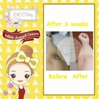 Gambar Noera Skin Lightening Cream - Armpit Pemutih Ketiak, Penghilang Bekas dari PUPUTRIN undefined 3 Tokopedia