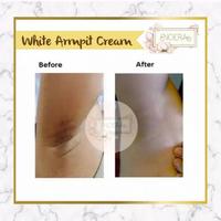 Gambar Noera Skin Lightening Cream - Armpit Pemutih Ketiak, Penghilang Bekas dari PUPUTRIN undefined 5 Tokopedia