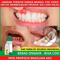 Gambar Obat Radang Gusi Bengkak Karena Gigi Berlubang - Gigi Ngilu - Sakit dari Toko Acep Herbals undefined 1 Tokopedia