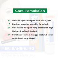 Gambar Penghilang Bekas Luka Hitam Koreng Meilibahenling Nutritive Cream Ori dari RAS Official Store undefined 4 Tokopedia