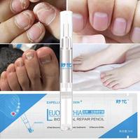Gambar Obat Jamur Kuku Leuconychia Cream Salep Cantengan Kuku Kaki dan Tangan - Nursing dari epe store undefined 1 Tokopedia