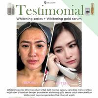 Gambar ms glow whitening series paket original dari MsGlowTangerangKota undefined 5 Tokopedia