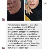 Gambar Beauty Water Acne Prone VAVL dari vavlbeaute_jaksel undefined 2 Tokopedia