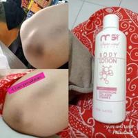 Gambar Lotion Glutacare MSI - Penghilang Strechmark, kulit belang, bekas luka dari mufieda26 undefined 5 Tokopedia