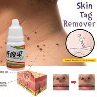 Gambar Obat Penghilang Kutil Mata Ikan Kapalan - Skin Tag Remover Removal dari Tobar.id undefined 5 Tokopedia
