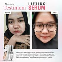 Gambar ms glow lifthing serum original bpom dari AOS Collections undefined 4 Tokopedia