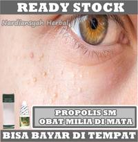 Gambar Obat Menghilangkan Milia, Bintik hitam, Bintik Putih Herbal di wajah dari azqiaraherbal undefined 1 Tokopedia