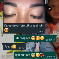 Gambar Serum acne Orlin beauty dari salmasnack_grosir undefined 4 Tokopedia