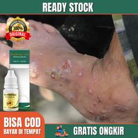 Gambar Obat Kulit Borok Budug Buduk Berair Bernanah Herpes - Propolis SM Asli dari Nafiza herbal undefined 1 Tokopedia