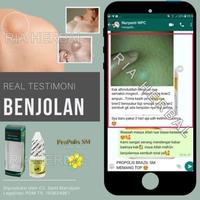 Gambar SALEP CAIR PENGHILANG BENJOLAN DI PUNGGUNG, LIPOMA TANGAN, LEHER OBAT dari Toko Myherbal undefined 2 Tokopedia