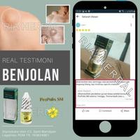 Gambar SALEP CAIR PENGHILANG BENJOLAN DI PUNGGUNG, LIPOMA TANGAN, LEHER OBAT dari Toko Myherbal undefined 4 Tokopedia
