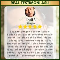 Gambar Obat Dermatitis Kontak Iritan Alergi Kulit Iritasi Paparan Kimia dari Iki Herbal undefined 5 Tokopedia