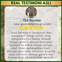 Gambar Obat Dermatitis Kontak Iritan Alergi Kulit Iritasi Paparan Kimia dari Iki Herbal undefined 4 Tokopedia