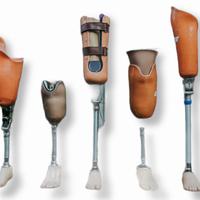 Gambar kaki palsu atas lutut dari Putra Medika Indonesia undefined 3 Tokopedia