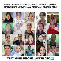 Gambar ISMILE USA PERAPIH GIGI ORIGINAL TEETH TRAINER ALIGNMENT PERAPI GIGI - Biru dari ISMILEUSA OFFICIAL undefined 3 Tokopedia