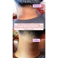 Gambar Toner Badan100ml Penghilang Daki Leher Ketiak Selangkangan Ampuh BPOM dari GROSIR MURAH JAYA undefined 4 Tokopedia