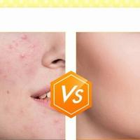 Gambar ROHTO MELANO CC TONER - Normal type dari Jastipnyakakak undefined 2 Tokopedia
