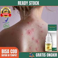 Gambar Propolis Sm-Obat Salep Kulit Cacar Air Cacar Api Cenang Biang Keringat dari Nafiza herbal undefined 1 Tokopedia