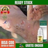 Gambar Obat Kulit Borok Buduk Bernanah Cenang Cacar Air Dermatitis- Propolis dari Nafiza herbal undefined 1 Tokopedia