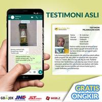 Gambar Obat Bopeng, Bekas Jerawat, Bekas Jerawat Hitam, Jerawat Bandel dari Ridwan Herbal_NEW undefined 5 Tokopedia
