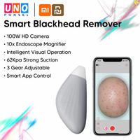 Gambar MEISHI SMART VISUAL BLACKHEAD REMOVER DEVICE Pembersih Komedo Jerawat dari Uno Ponsel undefined 1 Tokopedia