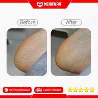 Gambar Showsee Electric Pedicure Callus Remover Penghalus Tumit Kulit Kaki - B1 Fullset dari Menawan-id undefined 3 Tokopedia