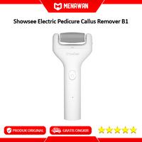 Gambar Showsee Electric Pedicure Callus Remover Penghalus Tumit Kulit Kaki - B1 Fullset dari Menawan-id undefined 1 Tokopedia