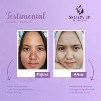 Gambar Paket glow up by sartika diman dari noviyantinurdin97 undefined 3 Tokopedia