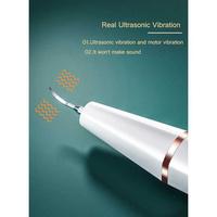 Gambar Pembersih Karang Plak Gigi Ultrasonic Dental Calculus Removal Electric dari OnePortal undefined 3 Tokopedia