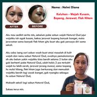 Gambar Sabun Wajah Menghilangkan Jerawat dan Bopeng - Natural Oud Herbal dari Reni Herbal undefined 5 Tokopedia