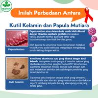 Gambar Obat Minum Kutil kelamin HPV di Kemaluan Pria dan wanita Paling Ampuh dari DE NATURE CENTER INDONESIA. undefined 2 Tokopedia