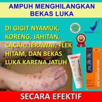 Gambar ORIGINAL Cream Penghilang Bekas Luka Lama Hitam Koreng Bopeng Jerawat dari Lovaribel Glowing undefined 5 Tokopedia