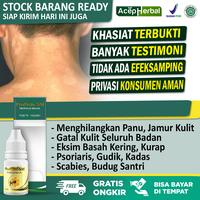 Gambar Obat Jamur Panu Hapuran Gatal Kulit Seluruh Badan Propolis SM dari Toko Acep Herbal Indonesia undefined 1 Tokopedia