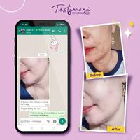 Gambar Pharmaskin Night Treatment Flek Series dari Pharmaskin Solution id undefined 5 Tokopedia
