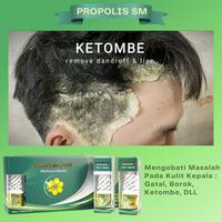 Gambar Obat Jamur Kulit Kepala Gatal Berkerak Kurap Eksim- PROPOLIS SM Ampu h dari Nafiza herbal undefined 1 Tokopedia