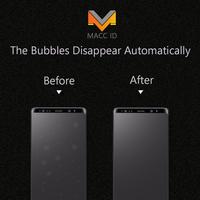 Gambar HYDROGEL PREMIUM UNTUK SEMUA TIPE OPPO - Anti Gores Full Screen - DEPAN, CLEAR dari Mixories undefined 5 Tokopedia