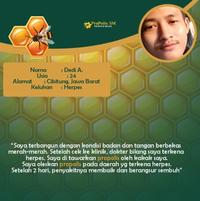 Gambar Salep Bisul di Pantat, Penghilang Bisul Bernanah, Nyeri Bisul Bermata dari Hasbi Herbal_NEW undefined 3 Tokopedia