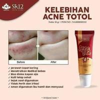 Gambar Obat jerawat ampuh / Acne totol SR12 dari Distributor Skincare herbal SR12 undefined 4 Tokopedia
