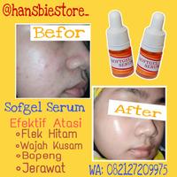 Gambar Softgel Serum Ampuh Hilangkan Flek Hitam Wajah kusam buy 1 get 1 dari BW Herbs undefined 4 Tokopedia