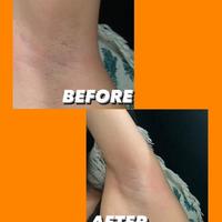 Gambar PEELING SPRAY YONISKINCARE PERONTOK DAKI PALING AMPUH WAJAH DAN BADAN dari Jitu Projects undefined 5 Tokopedia