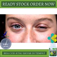 Gambar Obat Kelopak Mata Turun Sebelah, Obat Saraf Mata Lemah, Otot Lemah,Dll - 50 Kapsul dari Upiii Herbal undefined 1 Tokopedia