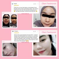 Gambar wazataru Skincare glowing-paket perawatan wajah glowing ala korea dari cheepiiawulandarii undefined 5 Tokopedia