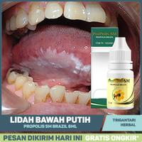 Gambar Obat Lidah Belakang Putih Leukoplakia Mulut Kering Propolis SM Origina dari Trigantari Herbal undefined 1 Tokopedia