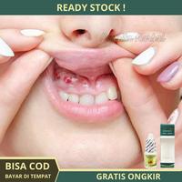 Gambar Obat Sakit Gusi, Gusi Bengkak, Nyeri Gusi, Gusi Berdarah, gusi Turun dari Puspita Herbal Store undefined 1 Tokopedia