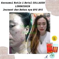 Gambar Collagen Dlemonie Pemutih Badan - 10 Kapsul dari Thirthy Official Store undefined 4 Tokopedia